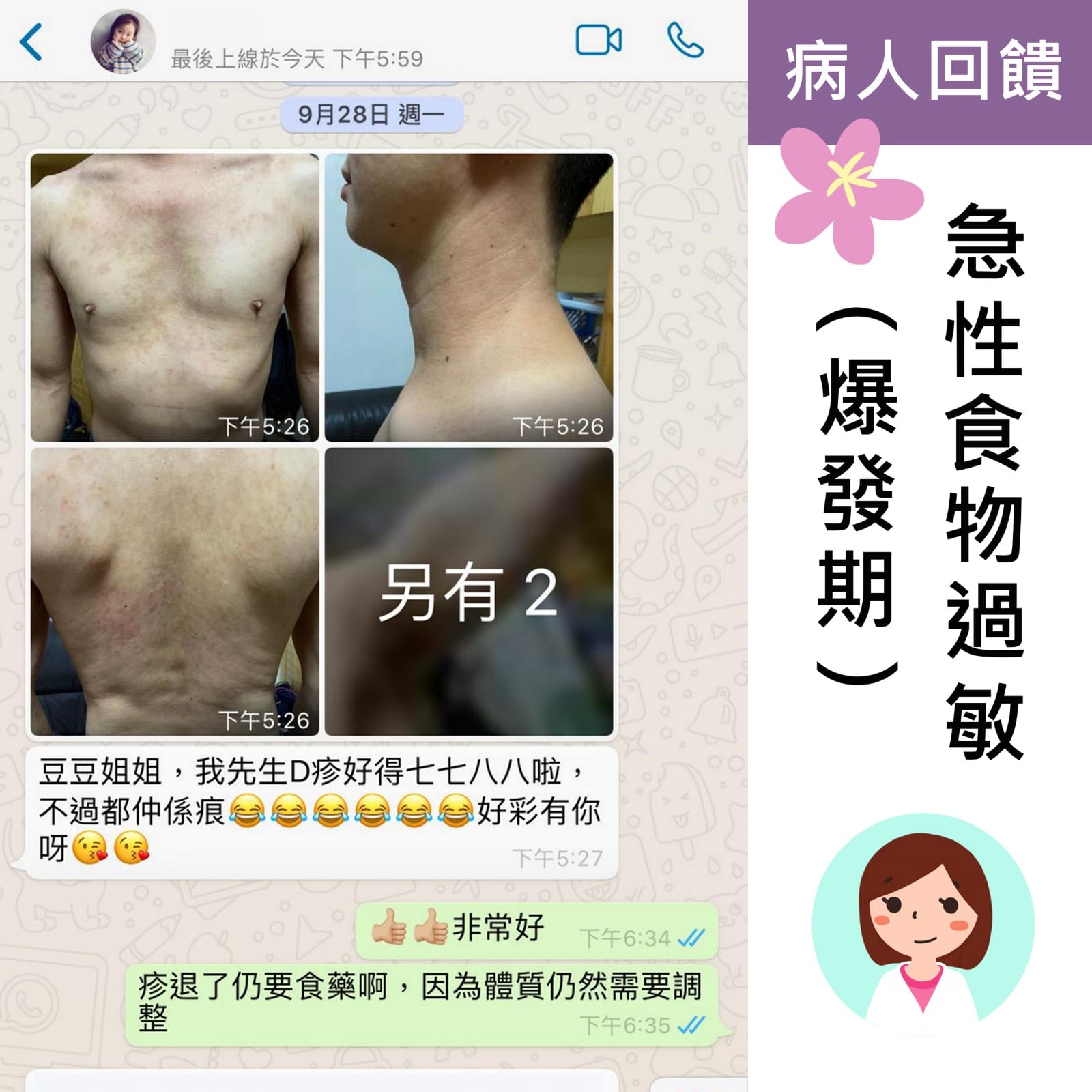 病例分享-急性食物過敏 病例分享-急性食物過敏